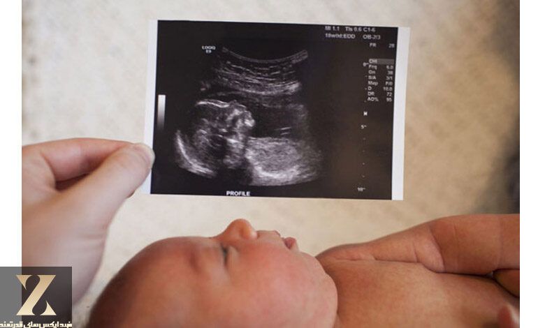 سونوگرافی در دوران بارداری