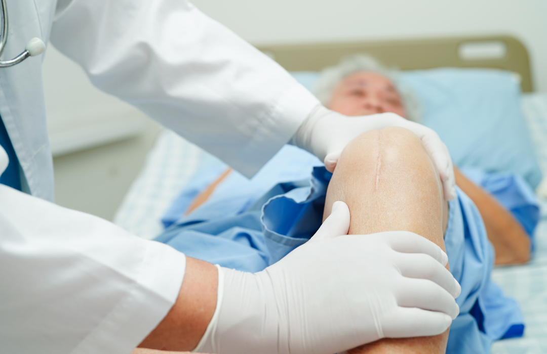 عمل پروتز زانو