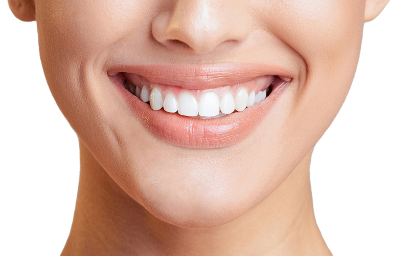 لبخند لثه ای